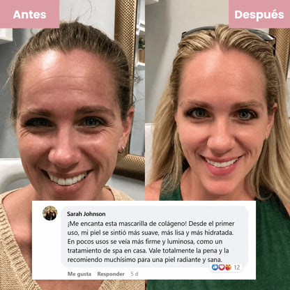 [es] Antes y después con comentario de clienta